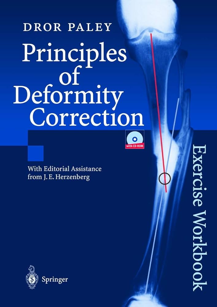 語学・辞書・学習参考書 principles of deformity correction Amazon | Principles of Deformity Correction | Paley, Dror